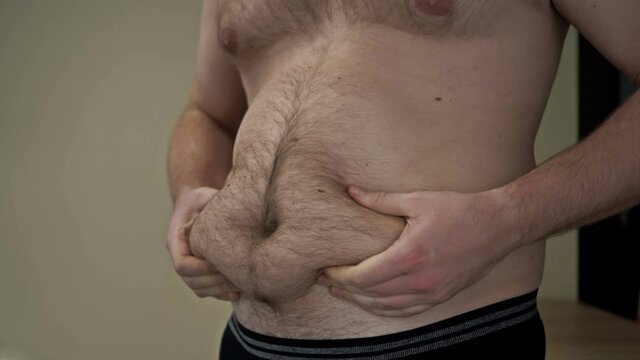 Plump man shows folds of excess fat on his belly. Overweight problem.