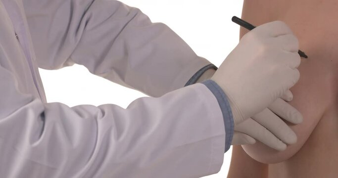 Plastic surgery doctor draw line on patient breast. Breast lift surgery. Isolated on the white background.
