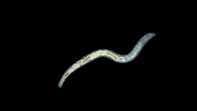 the worm Enchytraeus sp. under the microscope, Oligochaeta, order Haplotaxida. Lives both in soil and water. Diluted as food for aquarium fish