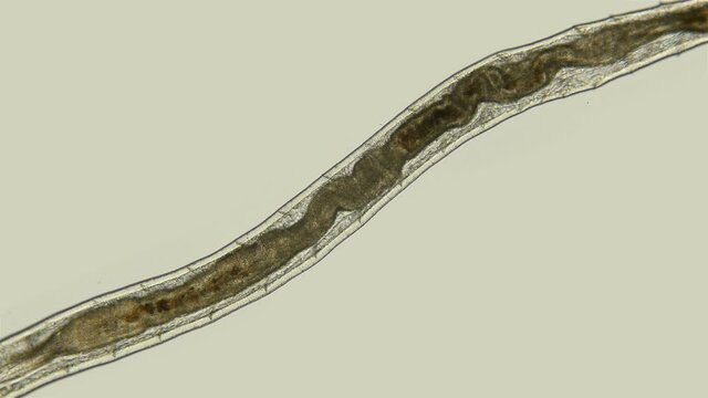the worm Enchytraeus sp. under the microscope, Oligochaeta, order Haplotaxida. Lives both in soil and water. Diluted as food for aquarium fish