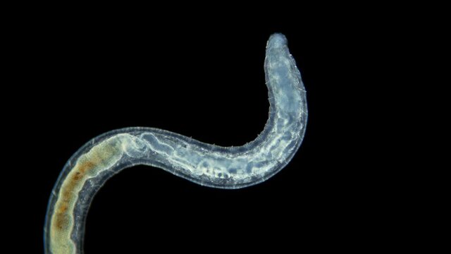 the worm Enchytraeus sp. under the microscope, Oligochaeta, order Haplotaxida. Lives both in soil and water. Diluted as food for aquarium fish