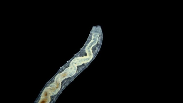 the worm Enchytraeus sp. under the microscope, Oligochaeta, order Haplotaxida. Lives both in soil and water. Diluted as food for aquarium fish