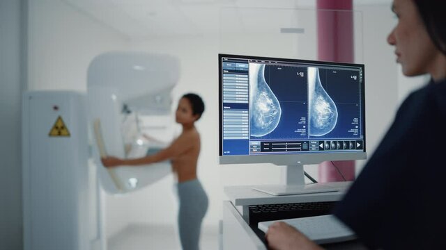 Computer Screen in Hospital Radiology Room: Beautiful Multiethnic Young Woman Standing Topless Undergoing Mammography Screening Procedure