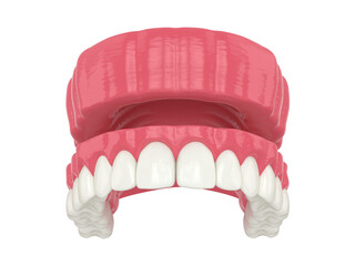 3d render of removable traditional denture installation