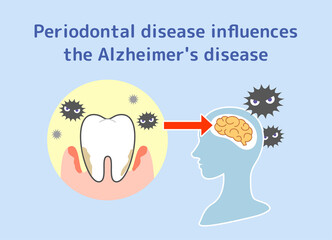 Fototapeta premium Relationship between periodontal disease and Alzheimer's disease