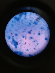 bacillus
