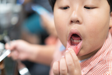 The boy was wounded by biting his own mouth.