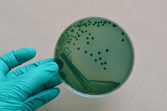 Vibrio Parahaemolyticus On Plate 