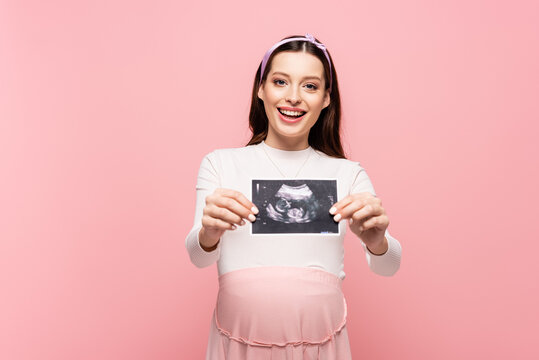  young pretty pregnant woman holding ultrasound scan isolated on pink