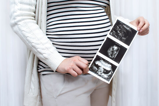 Cropped image of young pregnant woman holding ultrasound picture on belly. Concept of pregnancy, health care, gynecology, medicine. Mother waiting baby. Close-up.