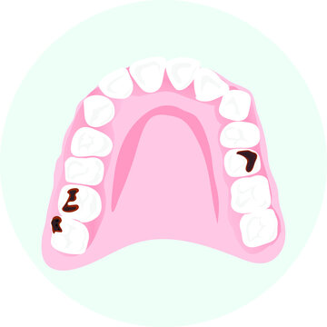 Vector icon of the lower jaw. Teeth with caries isolated