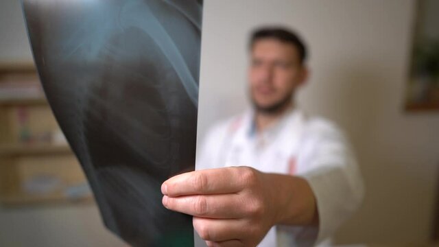 An experienced doctor looking at x-rays of the patients lungs. Close-up x-ray picture of the patient in the hand of the doctor. A patient with pneumonia, staging a diangosis coronavirus covid-19