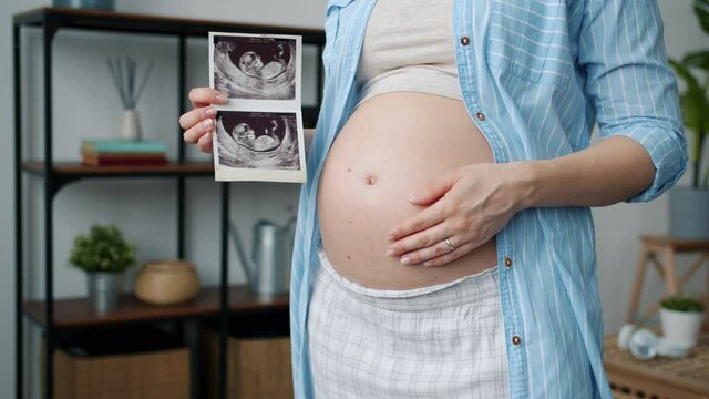 Close-up of cute pregnant belly and woman's hand holding sonogram image of healthy baby indoors in apartment. Pregnancy and women's health concept.