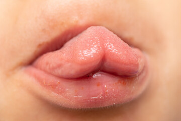 Folding tongue characteristic in child boy.