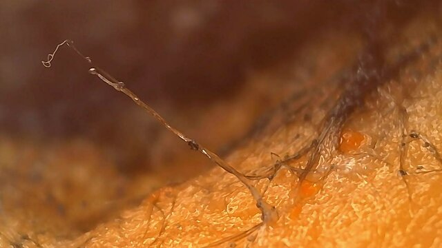 Microscope Mold Sporangiospore Stolon 1000x Biology Fungi