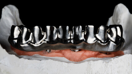 titanium dental bar for creating a ceramic prosthesis of the lower jaw on the model