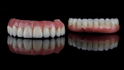 beautiful dental prosthesis of the upper and lower jaw made of high quality ceramic and titanium, laid out on black glass with reflection