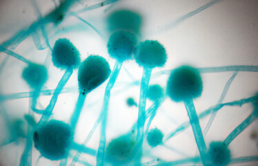 aspergillus under the microscope 