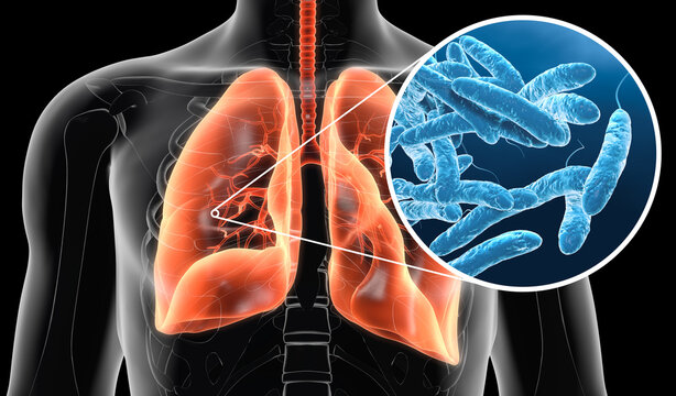 Legionella pneumophila bacteria in lungs, medically 3D illustration