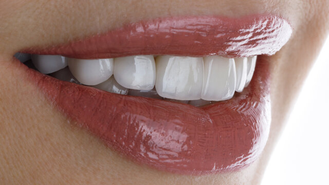 perfect smile of a girl with veneers and beautiful lipstick