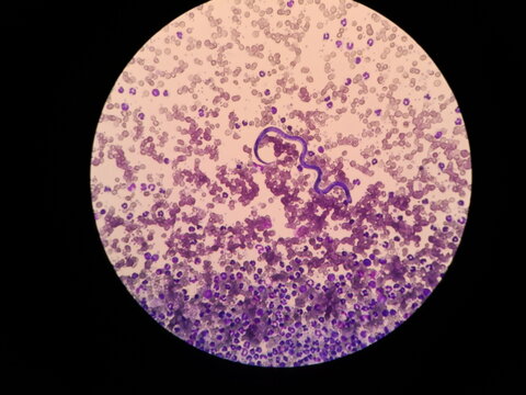 Microfilariae are not sheathed in the blood smear of a dog. Light microscope of heartworms, Dirofilaria immitis.