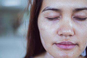 close up of face skin of women after laser removal wrinkles.