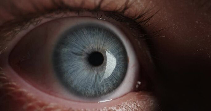 Red Eye with blue iris of tired guy looking around in complete exhaustion - sleep deprivation, anxiety, stress concept extreme close up 4k footage