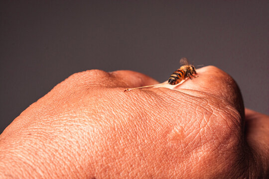 macro de una abeja obrera picando la mano de una persona 