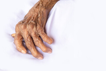 Fototapeta premium The hands of an old woman with rheumatoid arthritis. Diseases caused by degeneration of the joints of the fingers.