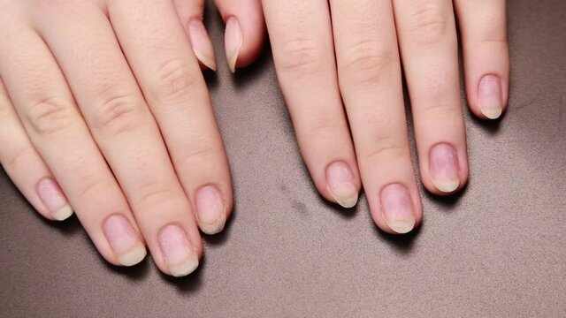 Woman hands fingers and nails during the manicure. Woman getting a manicure service at a beauty saloon or beauty shop. Woman natural  fingernails prepared to be covered with a nail polish or gel captu