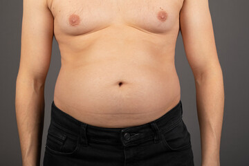 Bloated stomach close up