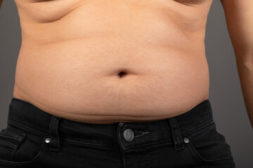 Naklejka premium Bloated stomach close up