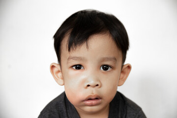 swollen face of asian kid suffering from health problem and aching tooth, showing dissatisfaction....