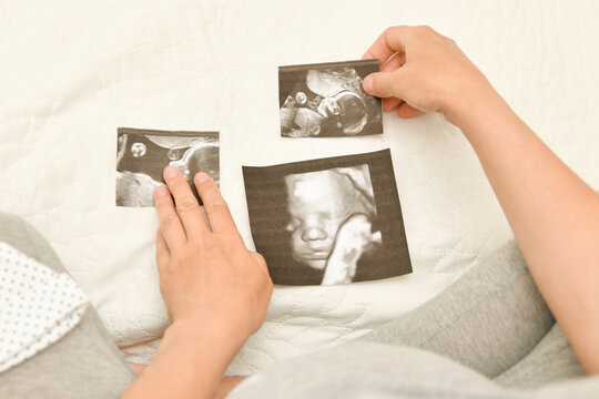 Pregnant woman holding 4D ultrasound image. Expectation of a child