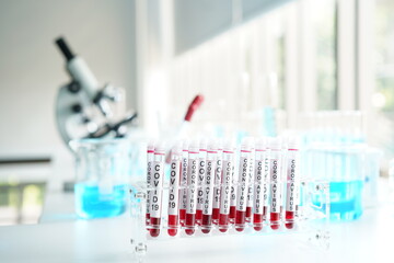 coronavirus covid 19 check, researchers are finding ways to eliminate the corona virus vaccine....