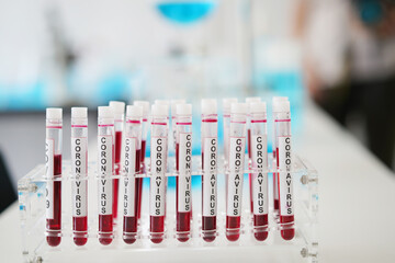 coronavirus covid 19 check, researchers are finding ways to eliminate the corona virus vaccine....