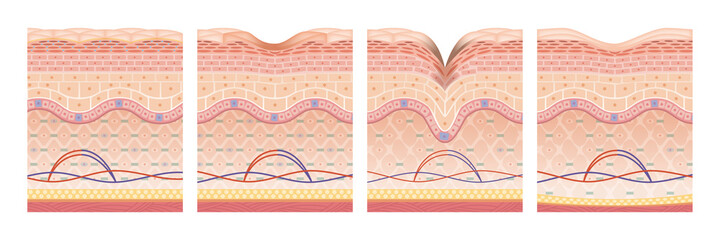 Cross section of the skin 10 front No commentary - obrazy, fototapety, plakaty