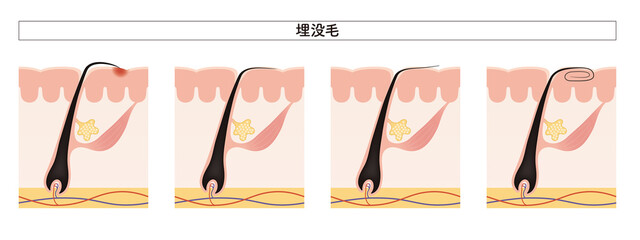 Cross section of the skin 25 front