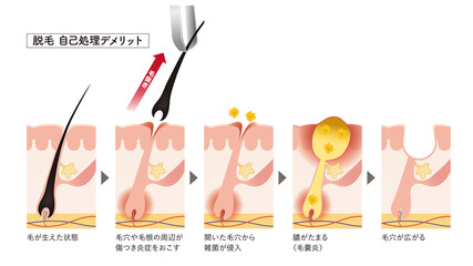 Cross section of the skin 26 front
