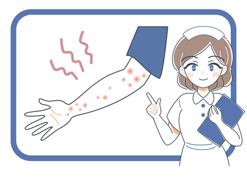 虫刺され 肌の炎症について説明する看護師のイラスト Stock Vector Adobe Stock