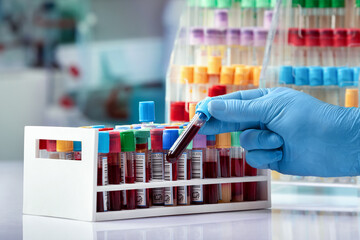 Doctor holding blood tube test in the blood bank laboratory of the Hospital / Technician with blood sample for analysis in the hematology lab