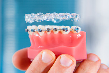 Dental care.Smiling orthodontist doctor holding aligners and braces in hand shows the difference...
