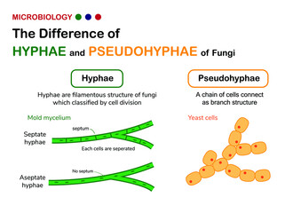 Biology diagram show difference of true hyphae (hypha) in fungi mold with pseudohyphae in yeast © trinset