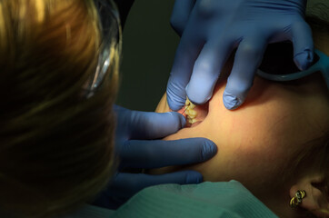 Children's dentist treats baby teeth	
