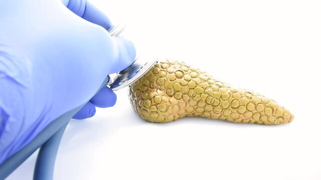 Doctor diagnoses anatomical model of pancreas with stethoscope in video. Concept for diagnosis, treatment, prevention and diet in pancreatic diseases such as pancreatitis, diabetes, cancer