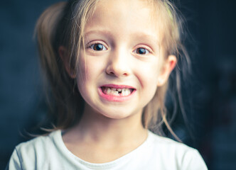 image of a little beautiful girl who lost a tooth