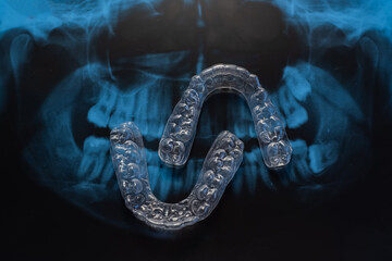 Transparent bite correction trays and x-ray of the jaw. Orthodontist equipment