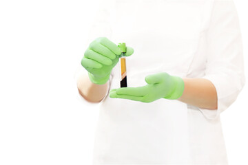 Medical test tube with blood plasma in hand for PRP therapy, after centrifuge
