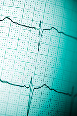 Electrocardiograph closeup view