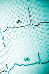 Electrocardiograph closeup view